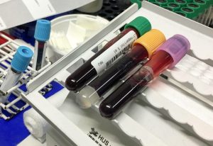 Verikokeessa Arkikuvia